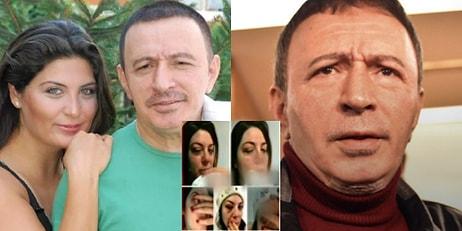 Korkunç İddia: Mustafa Topaloğlu'nun Eşi Yaralı Yüzünü Paylaştı, Sosyal Medya Ayağa Kalktı!