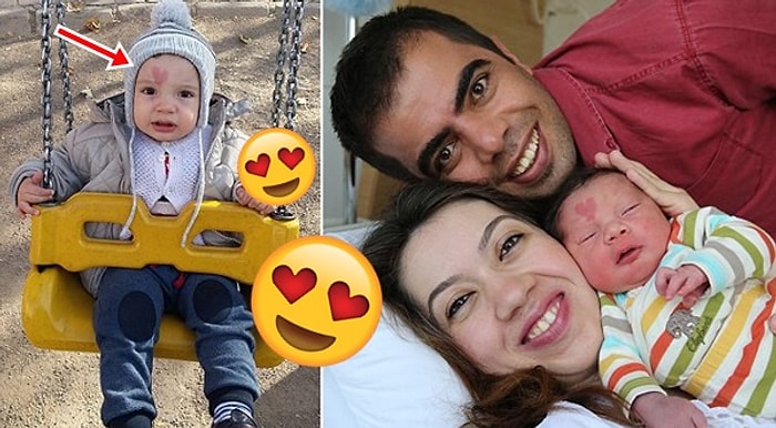 Seni Seviyorum Anne! Alnında Kalp Şeklinde Doğum Lekesiyle Doğan Çınar Bebek