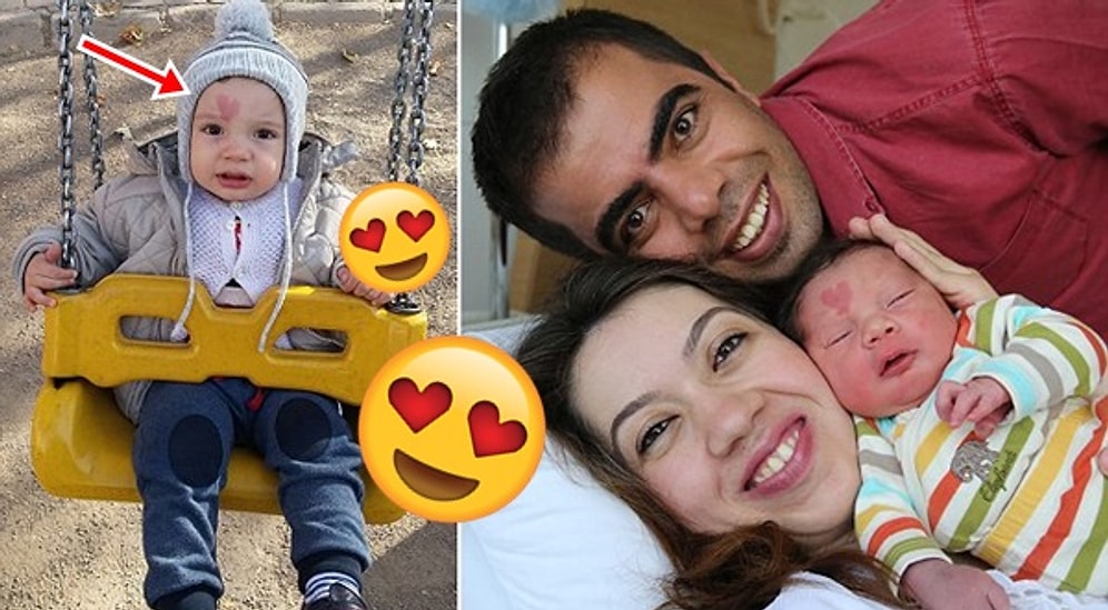 Seni Seviyorum Anne! Alnında Kalp Şeklinde Doğum Lekesiyle Doğan Çınar Bebek