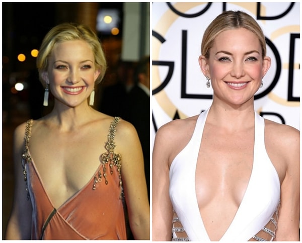 6. Кейт Хадсон: 15 000 долларов