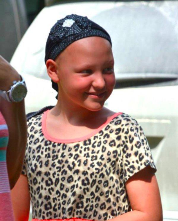 Gabby 4 yaşındayken alopecia areata olarak adlandırılan ve saçlarını kaybetmesine sebep olan otoimmun deri hastalığına yakalandı.Peruklar pahalı olduğu için saç bantları ve şapkalar kullanıyor.