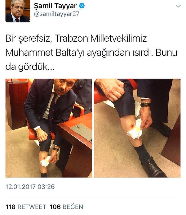 AKP'li Tayyar, Trabzon Milletvekili Muhammet Balta'nın ayağından ısırıldığını söyledi