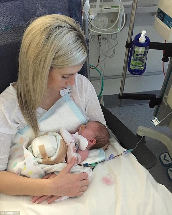 5. Маленькой девочке пришлось лежать только на спинке более 4 месяцев