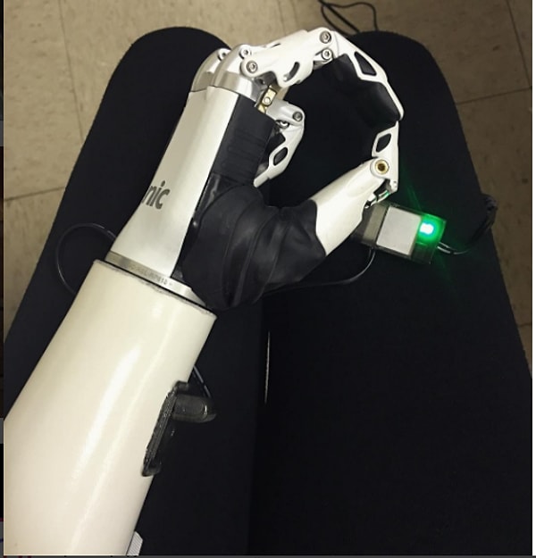 4. В декабре Мишель получила возможность расстаться с протезом, который носила с четырех лет, и обзавелась новой биомеханической рукой.