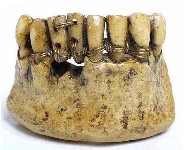 10. Ve protez dişler böyle oluyordu.