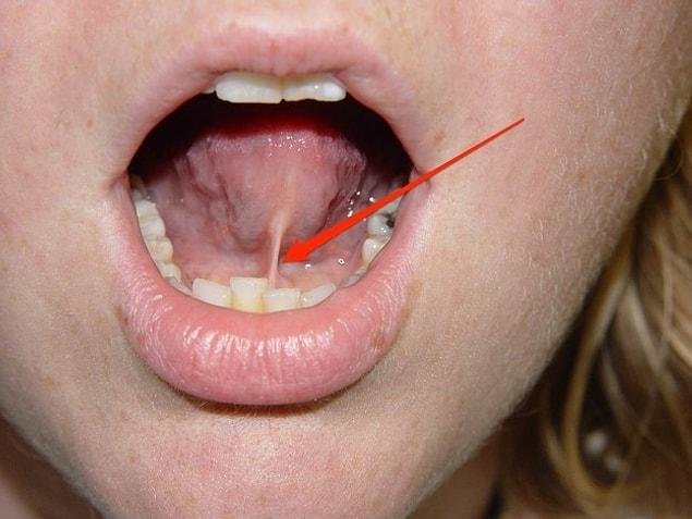 13. Frenulum: the small fold of mucous membrane extending from the floor of the mouth to the midline of the underside of the tongue.