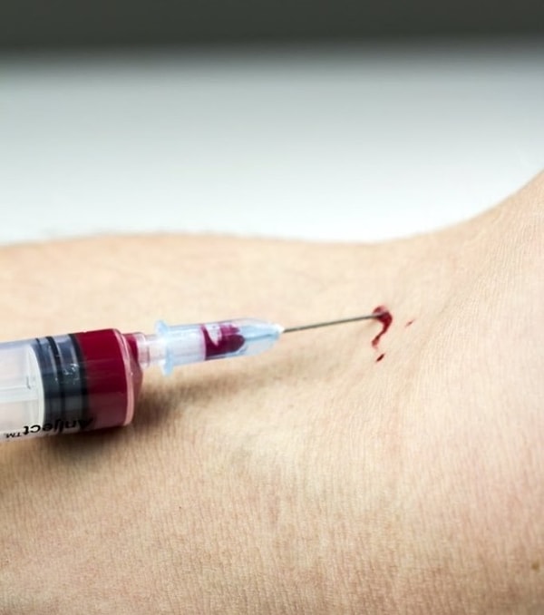 12. А ещё забор крови. Это картина определённо не понравится никому, так ведь?!