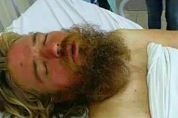 7. Когда брат встретил его, Антон выглядел достаточно потрепанным. За время, которое он провел в больнице, ожидая родственников, шизофрения обострилась.