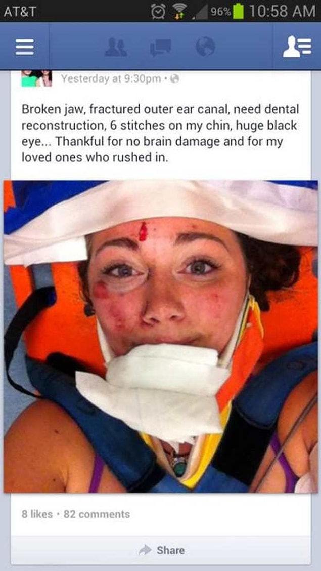 9. Abla çeneyi falan parçalamış darmadağın olmuş, hala selfie derdinde