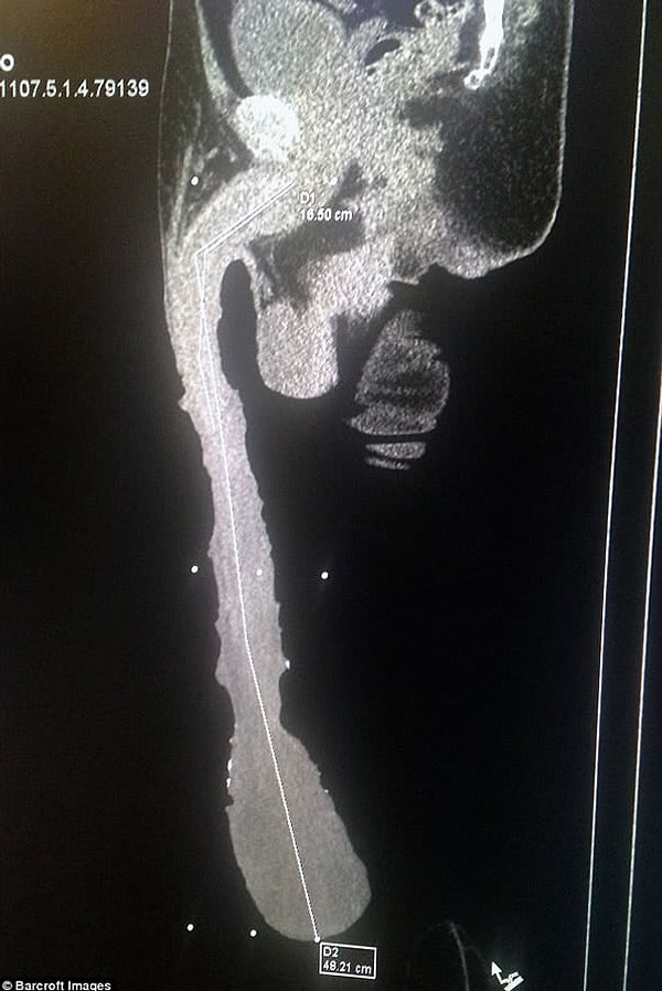 2. Длина полового члена Роберто составляет 48 см! Кабрера гордится этим, отмечая, что это достижение достойно Книги рекордов Гиннесса