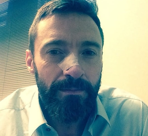 9. В 2014 году он поблагодарил своих докторов за удаление рака с носа