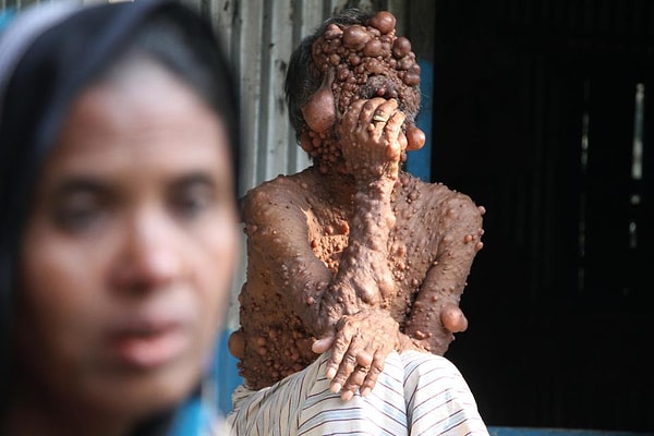 9. Жена Шадота тоже не может найти работу, так как вынуждена ухаживать за мужем