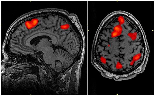 Ancak artık düşünceleri giderek artan bir kesinlikle bilmemizi sağlayan bir teknolojimiz var: fMRI.