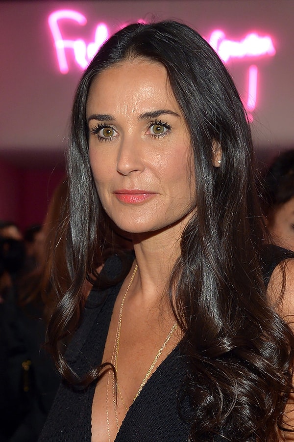 1. Носогубные складки