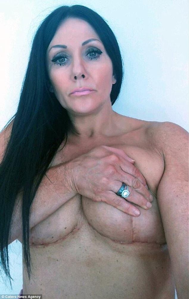 Janey, 48, got her first boob job in 2004.