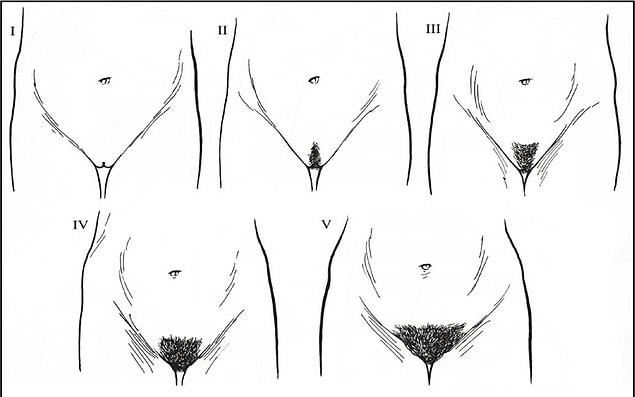 2. The Tanner staging system evaluates both breast development and pubic hair. Here are the steps: