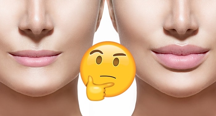 Bu Dudaklardan Hangisinde Dolgu Olmadığını Bulabilecek misin? 👄