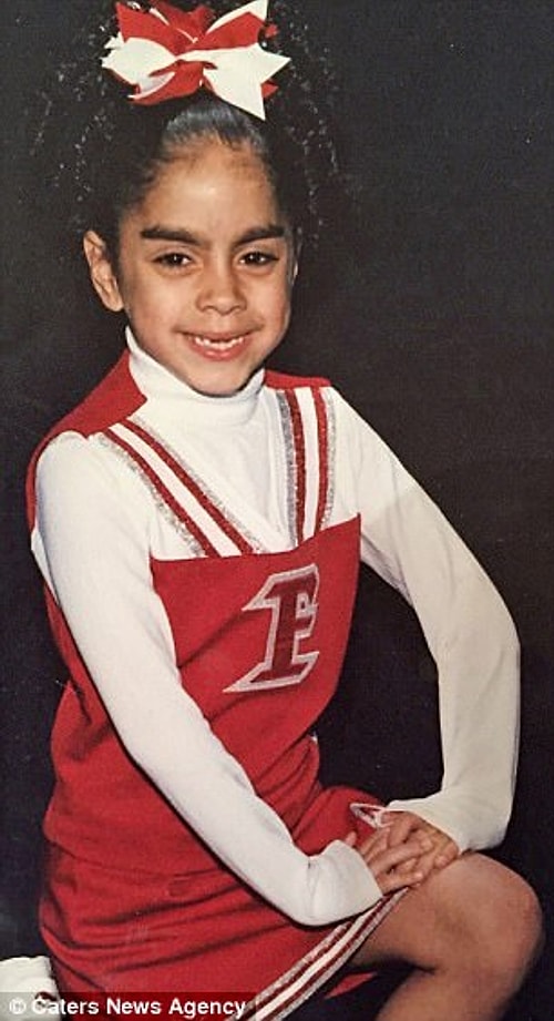Ashley'e teşhis konulmadan önce, soldaki fotoğrafta 10, sağdakinde ise 11 yaşında.