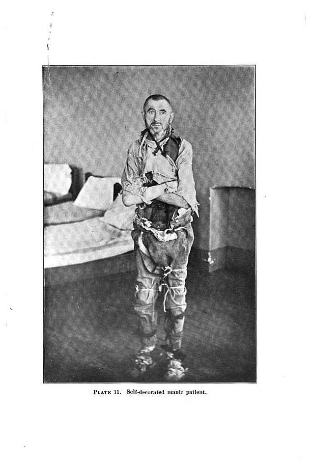 27. Self-decorated patient, Asylum life in the 1800s.