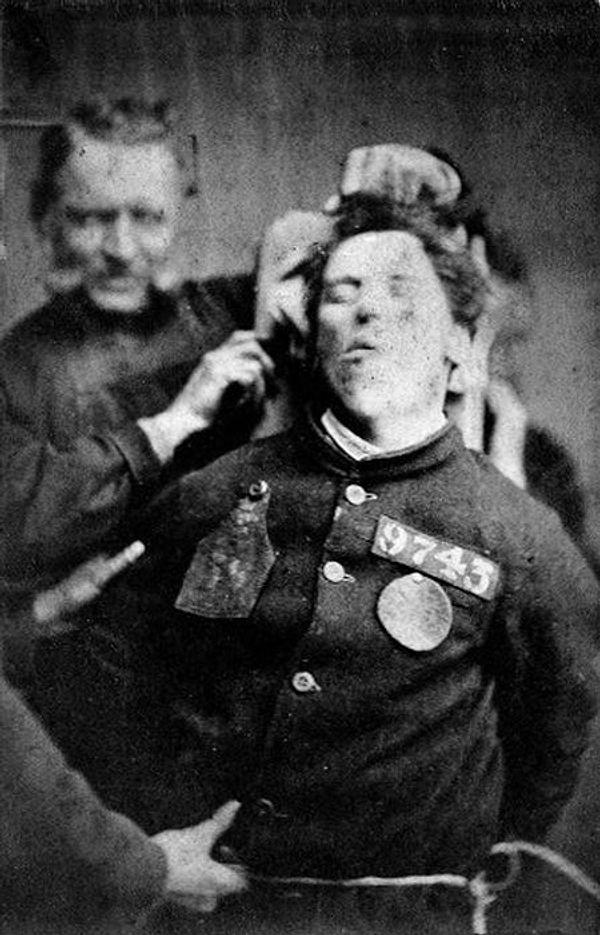 4. An insane asylum patient restrained by warders, Yorkshire, 1869, Henry Clarke.