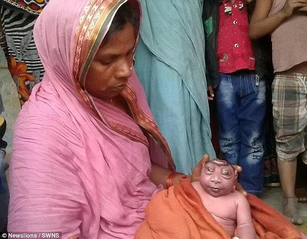 35 yaşındaki Khalida Begum, bu pazartesi gecesi doğum yaptı. Küçük kafalı, pörtlek gözlü bebeği görünce de şok geçirdi. Minik bebek "uzaylı" olarak adlandırıldı.