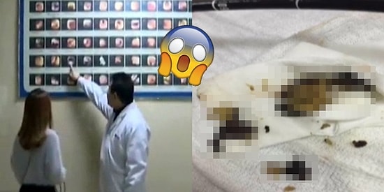 Midesinde Büyüyen İğrenç Mantarları Aldırmak İçin Sonunda Ameliyat Olmak Zorunda Kalan Kadın