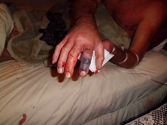 Kafasını Kopardığı Yılan Tarafından 20 Dakika Sonra Sokularak Öldürülen Çinli Adam