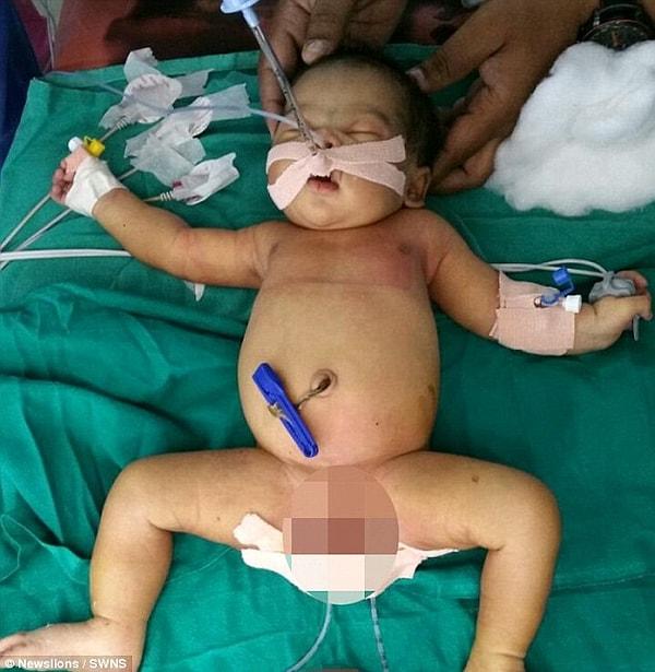 25 yaşındaki Srilatha Kanchanapally, Jangaon bölge hastanesinde bebeğini dünyaya getirdi.