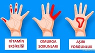 Ellerinizin Genel Vücut Sağlığınız Hakkında Veriyor Olabileceği 7 Önemli Sinyal