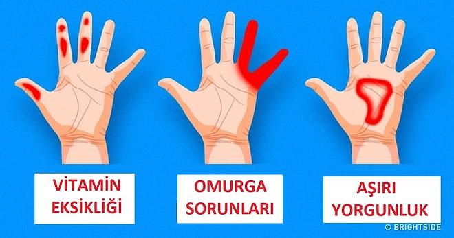 Ellerinizin Genel Vücut Sağlığınız Hakkında Veriyor Olabileceği 7 Önemli Sinyal