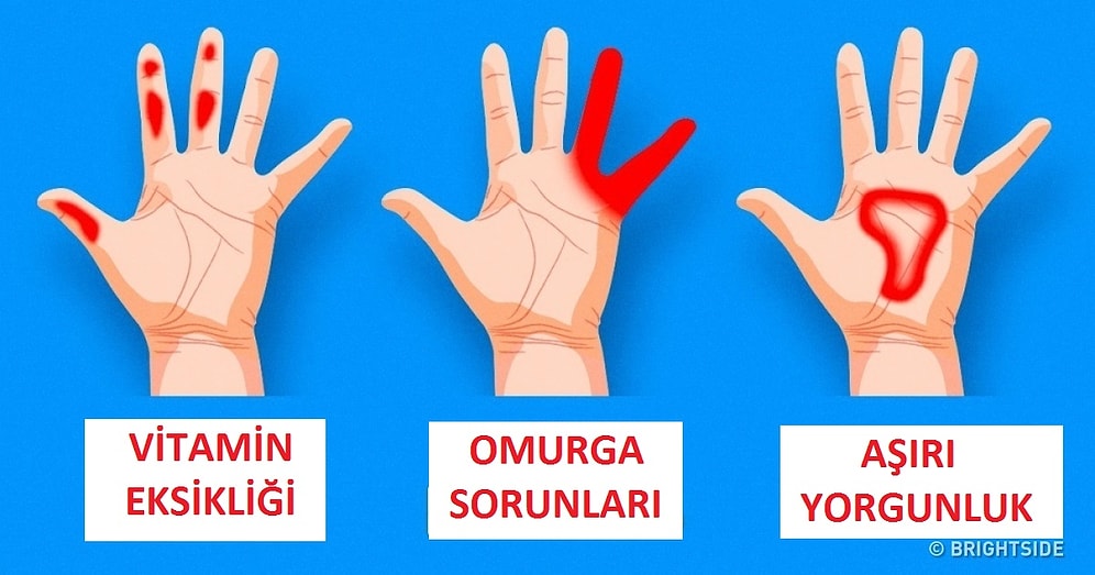 Ellerinizin Genel Vücut Sağlığınız Hakkında Veriyor Olabileceği 7 Önemli Sinyal
