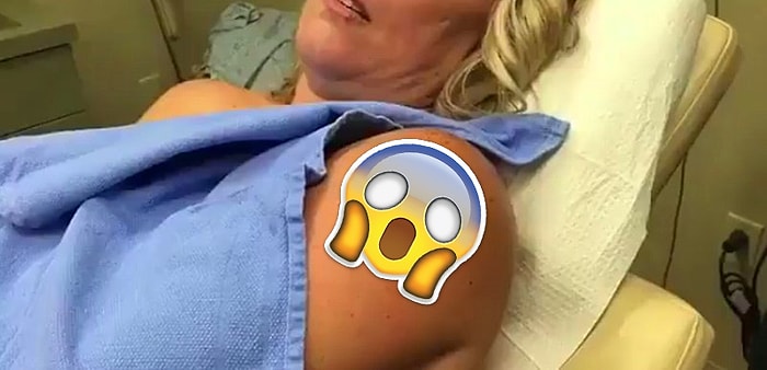 İzlemekten Zevk Alanlara Büyük Hizmet! Hipnotize Edici 15 Kist Sıkma Operasyonu