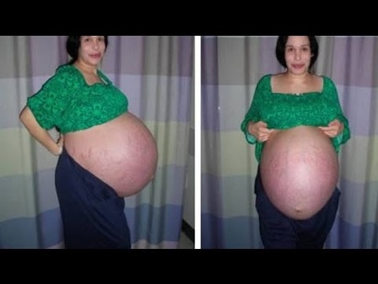 10 самых невероятных случаев материнства