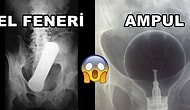 İnsanların Penis, Vajina ve Makatlarına Soktuğu Söylenen En Garip 17 Eşya