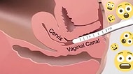 Jinekologlara Göre Kadınlar Arasında En Popüler 9 Vajina İşleminin Bilinmeyen Noktaları