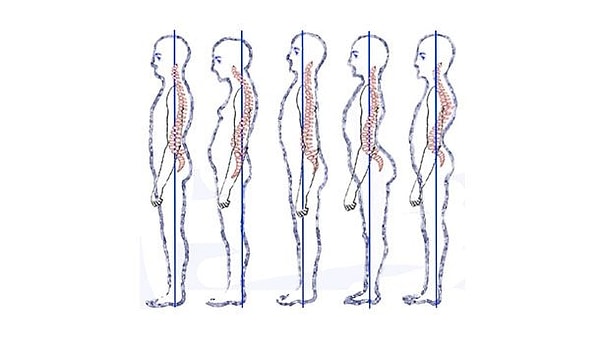 17. Сидеть сгорбившись