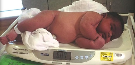 Невероятно: Женщина родила 6-килограммового младенца!