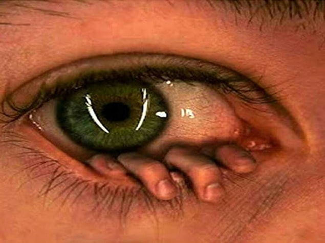 13. If you use contact lenses, you recognize that awful moment when something gets into your eye and you want to rip it out like a mad person.