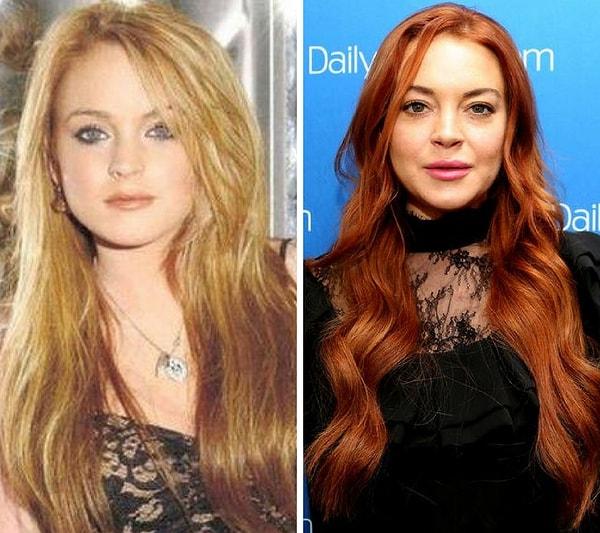 13. Bir dönemin çocuk yıldızı olan Lindsay Lohan henüz çok gençken estetik operasyon dünyasına adım attı ve bir daha da çıkamadı.