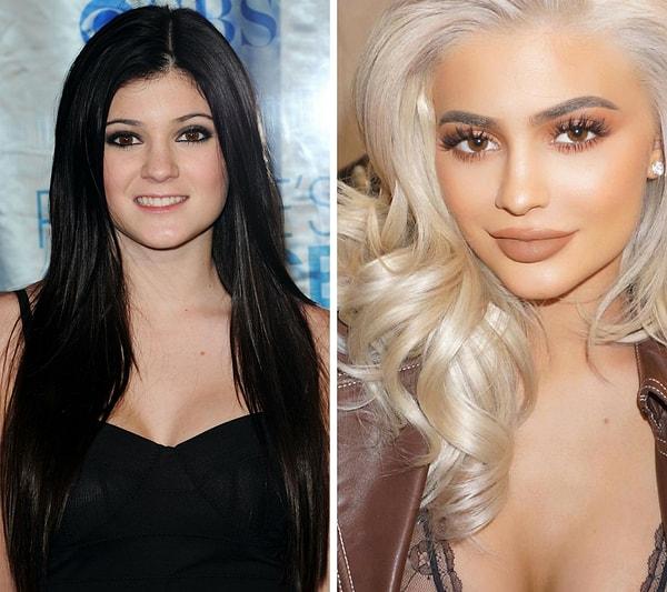 2. Genç yaşta estetik deyince akla tabii ki ilk olarak Kylie Jenner geliyor.