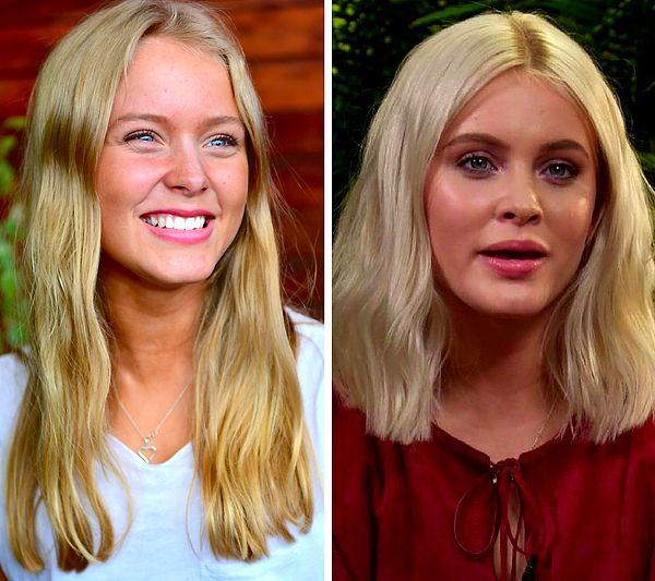 4. Singer, Zara Larsson, who will be 20 years old this year, has altered her appearance a lot over the years.
