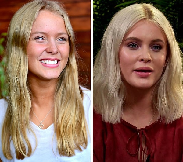 4. Singer, Zara Larsson, who will be 20 years old this year, has altered her appearance a lot over the years.