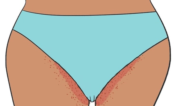 9. После каждой восковой эпиляции вы клянетесь больше никогда не делать ее.