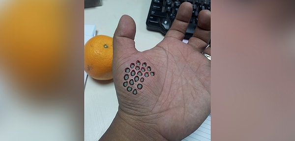 10. И еще немного ада трипофоба... Осталось совсем чуть-чуть