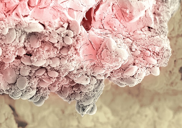 1. Так под микроскопом выглядит тортик. Не слишком аппетитно, не так ли?