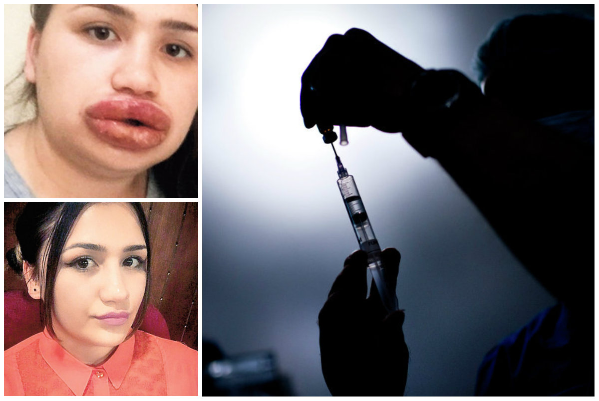 Sağlıklı dudaklar için 10 altın öneri Sağlıklı dudaklar için 10 altın öneri
