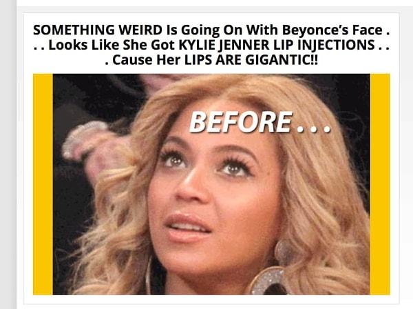 Ancak geçtiğimiz hafta, 'MediaTakeOut'un yayınladığı bir haber Beyonce'nin dudaklarına dikkat çekti ve estetik olduğu yönünde iddialar ortaya attı.