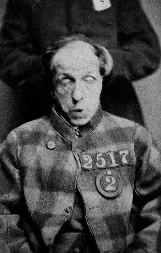21. Akıl hastası olan bir suçlunun 1869 yılında akıl hastanesinde çekilmiş fotoğrafı.
