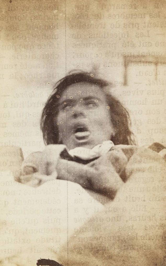 4. A psychiatric patient poses for a photo at Paris' Salpêtrière Hospital circa 1876-1877.