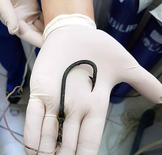 10 santimetrelik olta iğnesi ve misina çıkarıldı